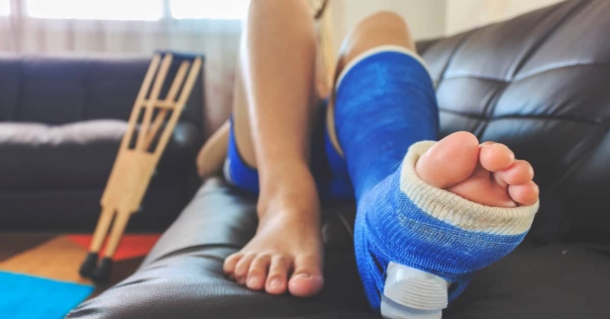 Broken Leg Injury Lawyers in GA The Eichholz Law Firm