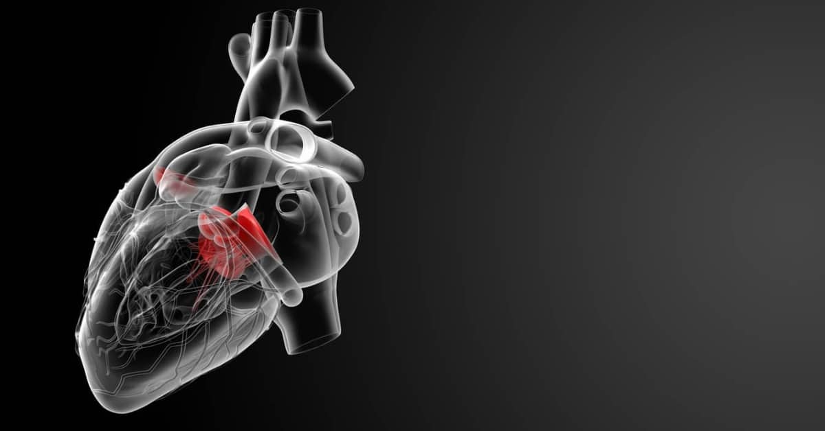 Johnson & Johnson Heart Valve Recall Lawyer in GA The Eichholz Law Firm